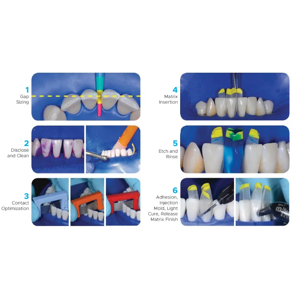No.8  TruContact Kit